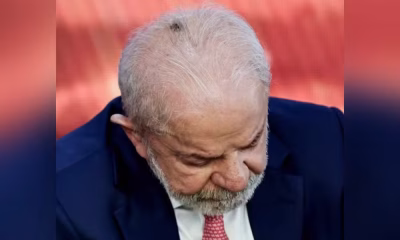 Lula passará por procedimentos médicos na cabeça e no punho nesta sexta-feira (24)