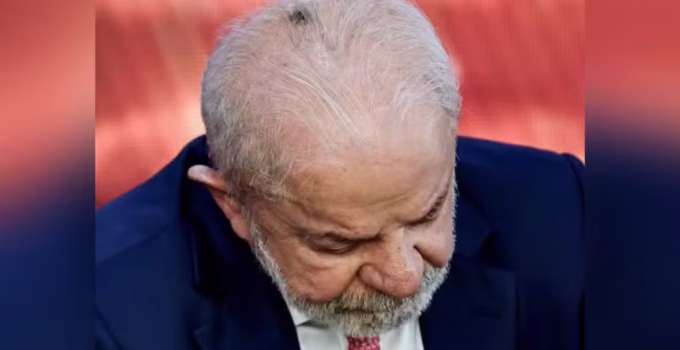 Lula passará por procedimentos médicos na cabeça e no punho nesta sexta-feira (24)