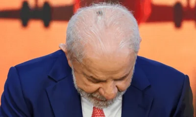 Lula passará por novas cauterizações e tratará tendinite no polegar direito