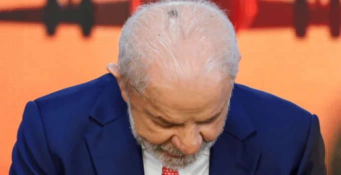 Lula passará por novas cauterizações e tratará tendinite no polegar direito