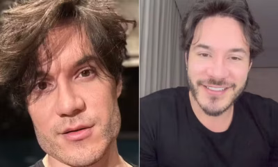 Eliezer revela arrependimento e crise de imagem após procedimentos estéticos: 'Virei um Frankenstein'