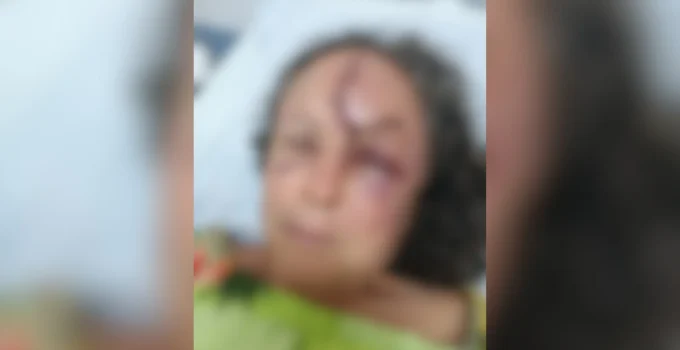Briga por Herança em Fazenda de MG: Irmãos Presos Após Agressão Violenta Contra Irmã e Família