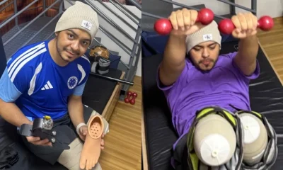 Jovem que perdeu pernas em acidente na Nossa Senhora do Carmo faz vaquinha para recomeçar a vida em BH