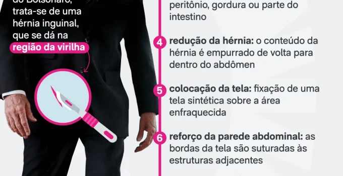 Flávio Bolsonaro lerá carta de Jair Bolsonaro antes de cirurgia; ex-presidente demonstra ansiedade