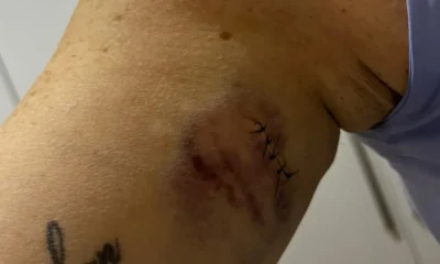 Sobrevivente de tentativa de feminicídio em BH relata milagre: 'Deus me ressuscitou'