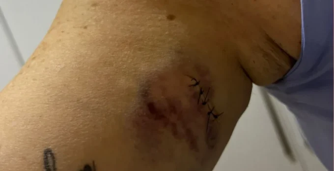 Sobrevivente de tentativa de feminicídio em BH relata milagre: 'Deus me ressuscitou'