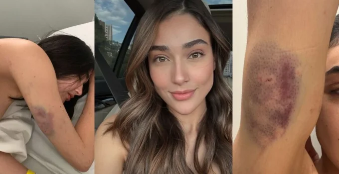 Empresária relata espancamento e ameaças de morte pelo ex-companheiro em Belo Horizonte na virada do ano