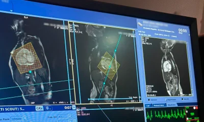 Hospital Márcio Cunha Revoluciona Cardiologia Pediátrica no Vale do Aço com Primeira Ressonância Cardíaca Infantil