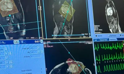 Hospital Márcio Cunha Inova e Realiza Primeira Ressonância Cardíaca Pediátrica do Vale do Aço