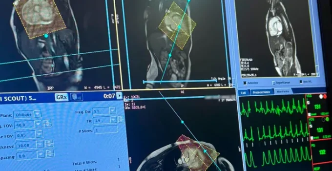 Hospital Márcio Cunha Inova e Realiza Primeira Ressonância Cardíaca Pediátrica do Vale do Aço