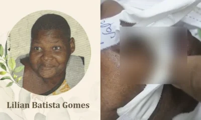 Mulher com larvas no corpo em hospital de BH será velada nesta terça; família denuncia descaso