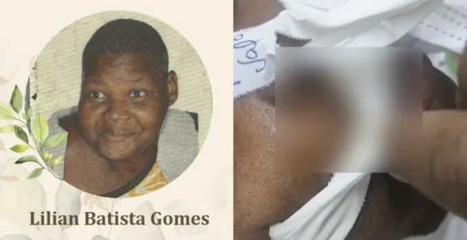 Mulher com larvas no corpo em hospital de BH será velada nesta terça; família denuncia descaso