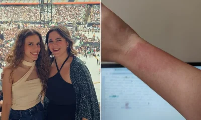 Pulseiras de LED de show de Luan Santana em BH causam queimaduras em fãs; equipe se manifesta