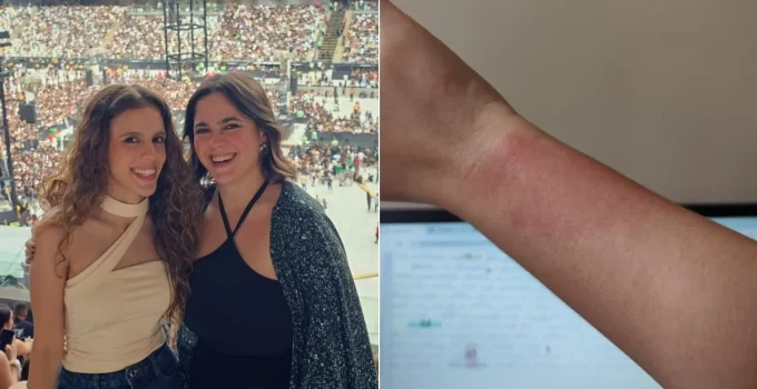 Pulseiras de LED de show de Luan Santana em BH causam queimaduras em fãs; equipe se manifesta