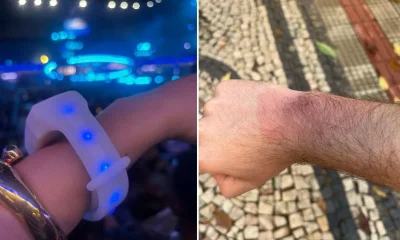 Pulseiras de LED do show de Luan Santana em BH causam queimaduras em fãs; veja orientações médicas
