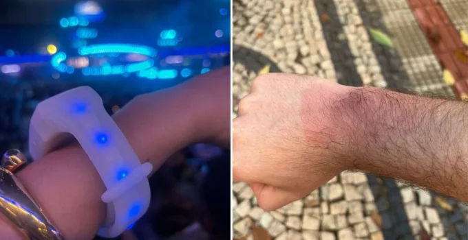 Pulseiras de LED do show de Luan Santana em BH causam queimaduras em fãs; veja orientações médicas