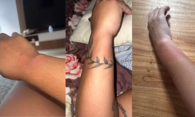 Queimaduras em Fãs de Luan Santana em BH: Pulseiras Luminosas Causam Reações na Arena MRV