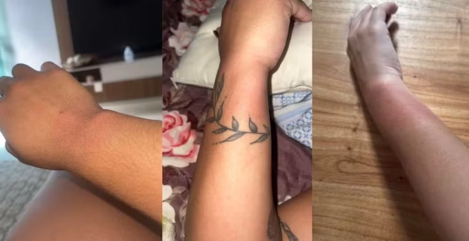 Queimaduras em Fãs de Luan Santana em BH: Pulseiras Luminosas Causam Reações na Arena MRV