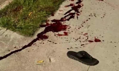 Pitbull Solto Ataca Homem no Barreiro e Gera Onda de Medo; Moradores Denunciam Insegurança Crônica na Região