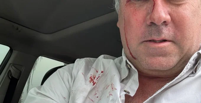 Pré-candidato à presidência do Peru, Rafael Belaunde Llosa, escapa ileso de ataque a tiros em Cerro Azul